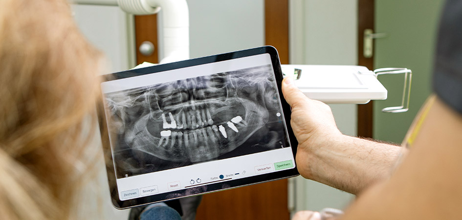 Implantate / feste Zähne